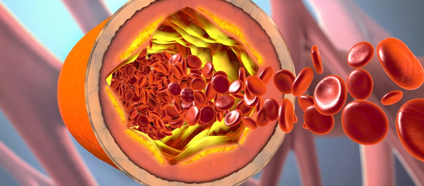 Χοληστερίνη: Ποια τα δύο είδη & ποιες οι φυσιολογικές τιμές